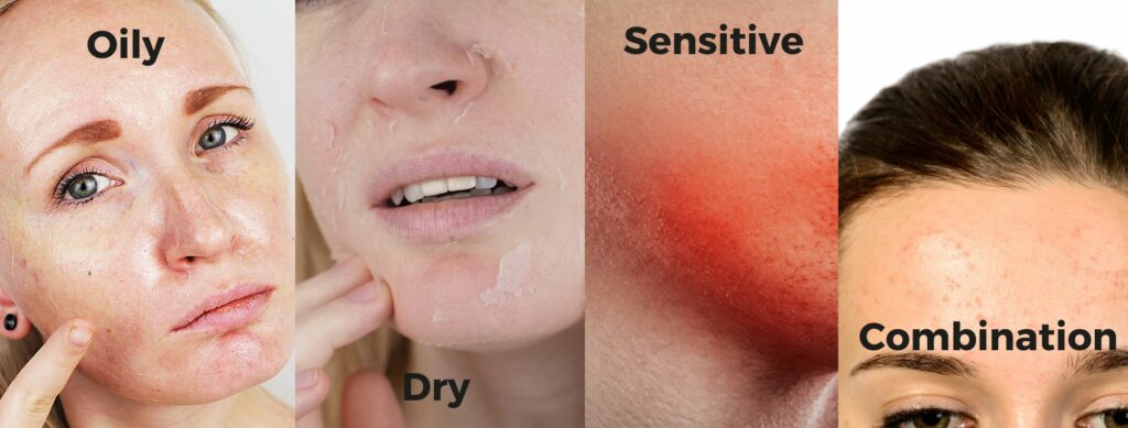 The Different Skin Types You Can Have